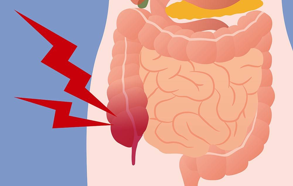Pain of appendix may be due to cancer